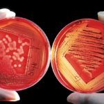Уничтожение бактерий, микробов